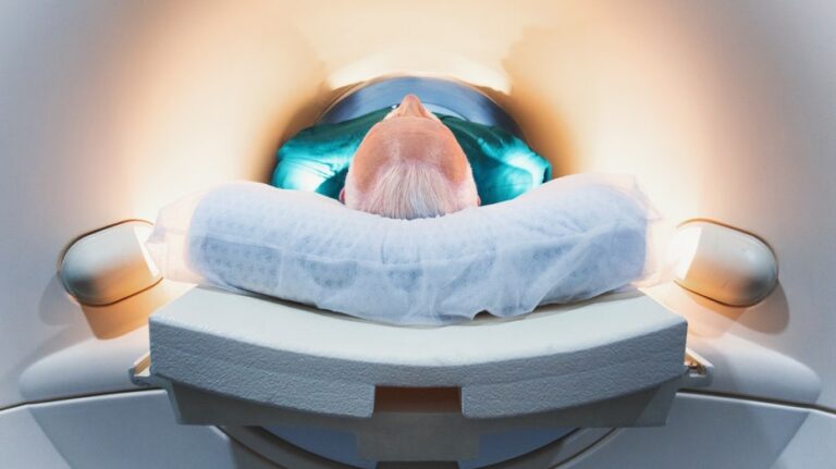 Cambios cerebrales a los 50 años pueden aumentar riesgo de demencia